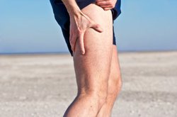 How to Treat Shin Splints