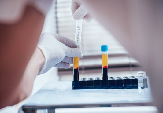 What is PRP?