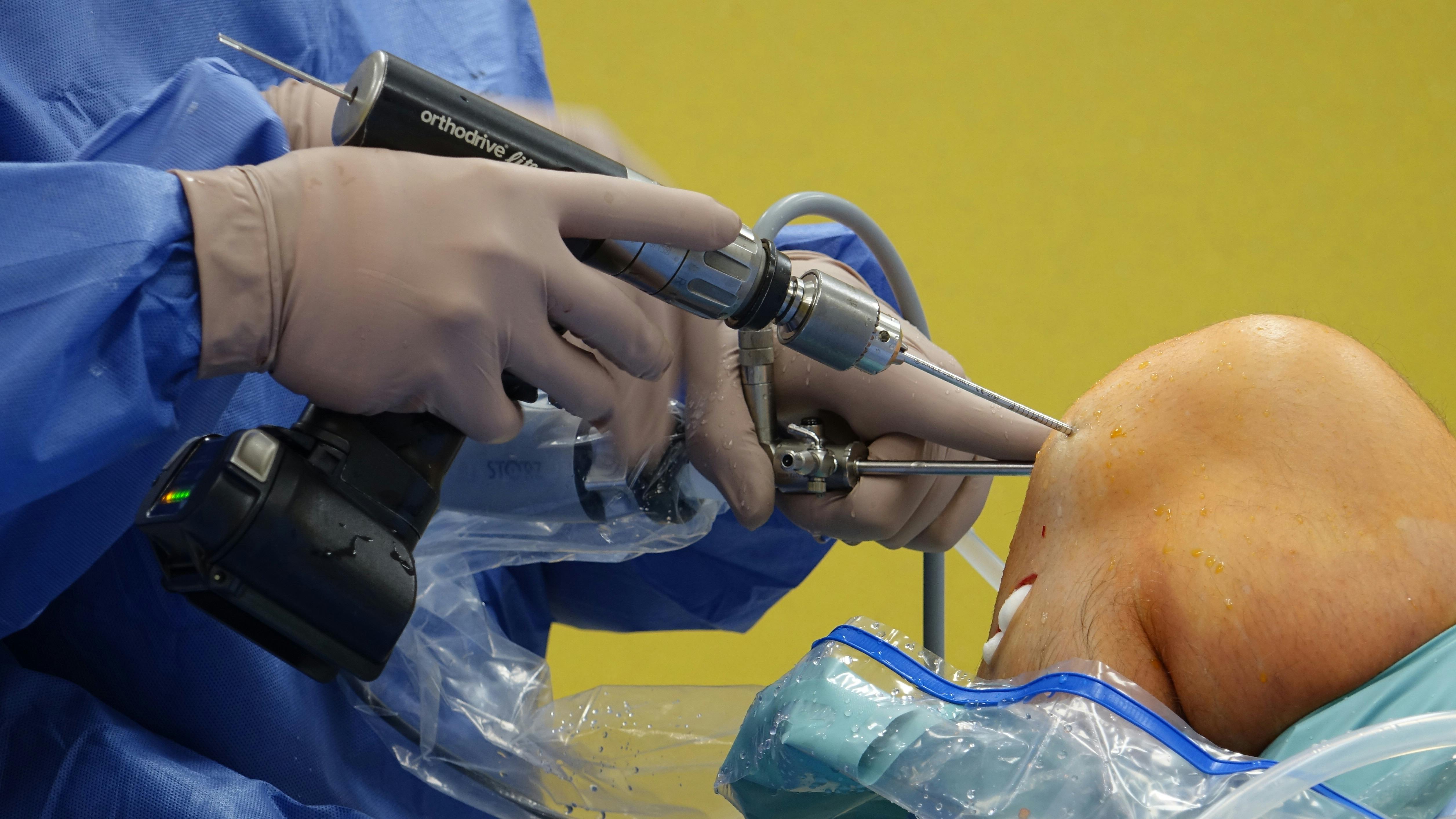 Knee Solutions