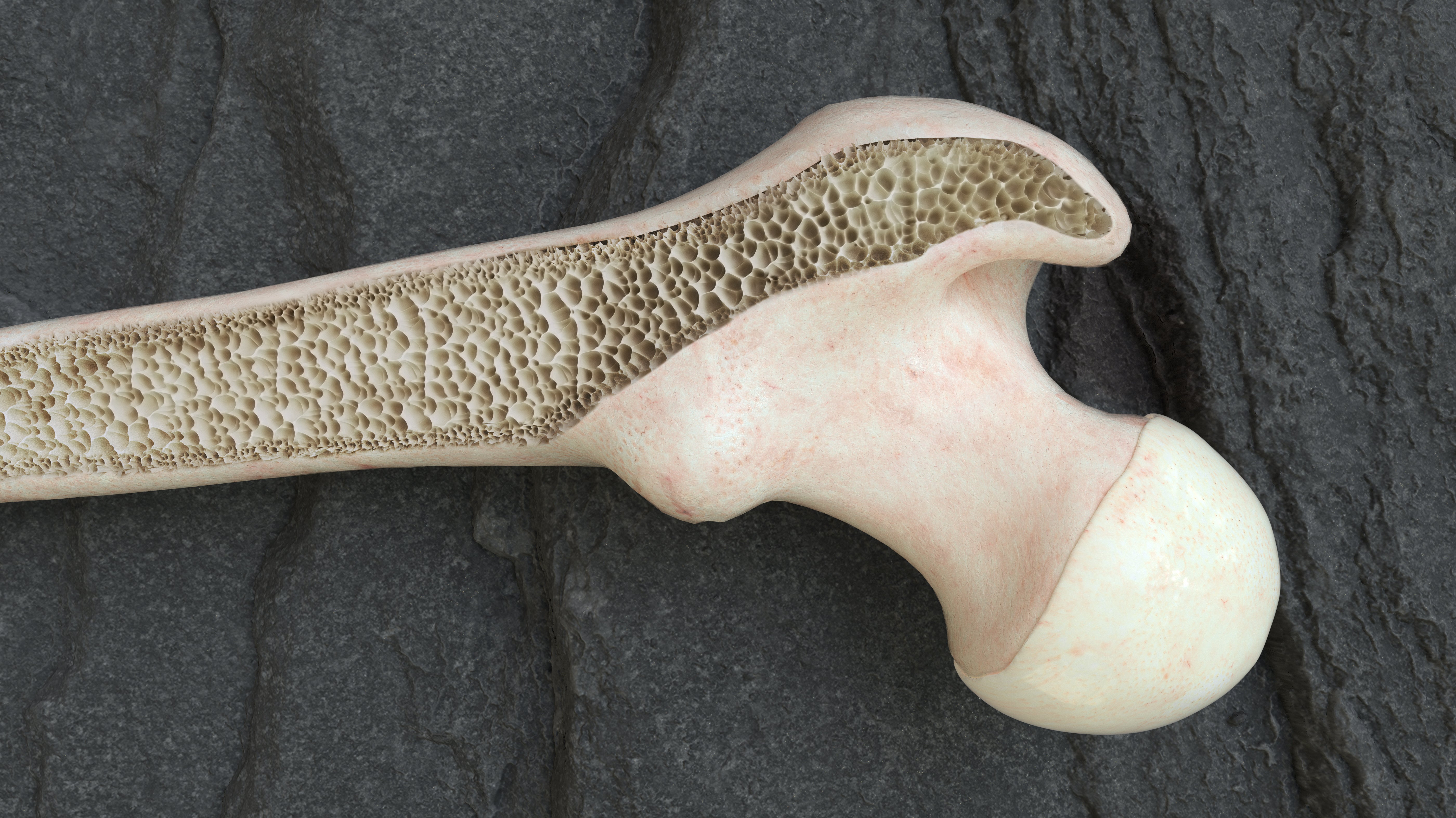 Hip Preservation & Surgery